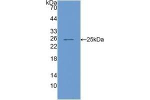 COMP anticorps  (AA 554-753)