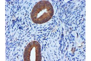 Image no. 2 for anti-Metalloproteinase Inhibitor 2 (TIMP2) antibody (ABIN1501393) (TIMP2 antibody)