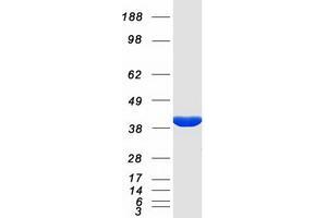 Validation with Western Blot