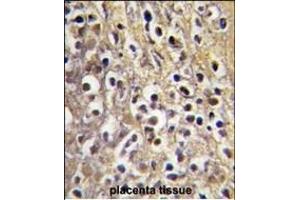 Formalin-fixed and paraffin-embedded human placenta tissue reacted with CYP19A1 antibody (C-term) (ABIN391826 and ABIN2841671) , which was peroxidase-conjugated to the secondary antibody, followed by DAB staining. (Aromatase antibody  (C-Term))