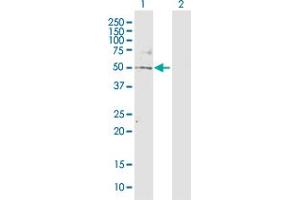 Western Blot analysis of TBL2 expression in transfected 293T cell line by TBL2 MaxPab polyclonal antibody. (TBL2 antibody  (AA 1-447))