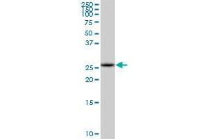 COMTD1 MaxPab polyclonal antibody. (COMTD1 antibody  (AA 1-262))