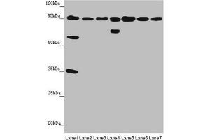 Western blot All lanes: NELL1 antibody at 3. (NELL1 antibody  (AA 160-420))