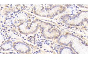 Detection of CASP7 in Human Stomach Tissue using Polyclonal Antibody to Caspase 7 (CASP7) (Caspase 7 antibody  (AA 207-303))