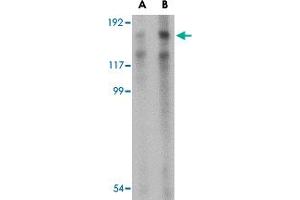 Western blot analysis of TARBP1 in NIH/3T3 cell lysate with TARBP1 polyclonal antibody  at (A) 1 and (B) 2 ug/mL . (TARBP1 antibody  (Internal Region))