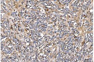 IHC analysis of Alpha 2 Antiplasmin/SERPINF2 using anti-Alpha 2 Antiplasmin/SERPINF2 antibody (ABIN7601808). (alpha 2 Antiplasmin antibody  (AA 461-491))