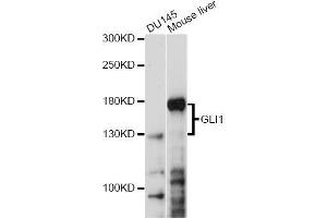 Western blot analysis of extracts of various cell lines, using GLI1 antibody. (GLI1 antibody)