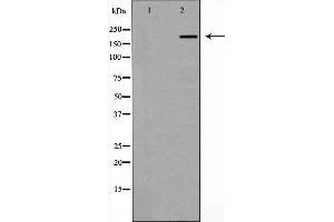 Western blot analysis of ZO 1 expression in Human brain,The lane on the left is treated with the antigen-specific peptide. (TJP1 antibody)