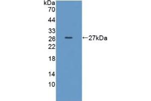 Western blot analysis of recombinant Human TPMT. (TPMT antibody  (AA 26-227))