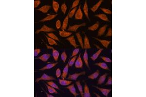 Immunofluorescence analysis of L929 cells using SMYD3 antibody (ABIN7270260) at dilution of 1:100. (SMYD3 antibody  (AA 50-150))