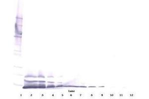Image no. 4 for anti-Chemokine (C-X-C Motif) Ligand 14 (CXCL14) antibody (ABIN465239) (CXCL14 antibody)