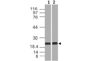 Image no. 1 for anti-Chromobox Homolog 5 (CBX5) antibody (ABIN5027696) (CBX5 antibody)