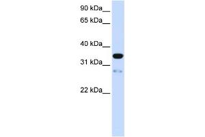 WB Suggested Anti-TMEM38A Antibody Titration:  0. (TMEM38A antibody  (N-Term))