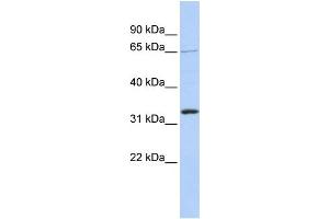 WB Suggested Anti-GRHL2 Antibody Titration:  1 ug/ml  Positive Control:  721_B cell lysate (GRHL2 antibody  (Middle Region))