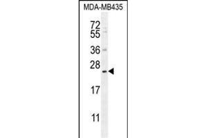 FA Antibody (N-term) (ABIN656101 and ABIN2845443) western blot analysis in MDA-M cell line lysates (35 μg/lane). (FAM109A antibody  (N-Term))