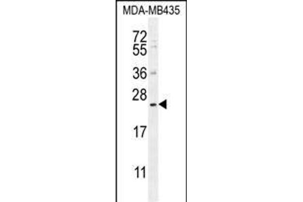 FAM109A anticorps  (N-Term)