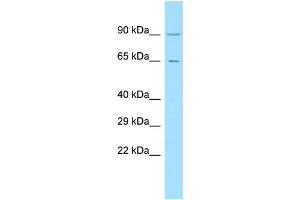 WB Suggested Anti-C11orf2 Antibody Titration: 1. (VPS51 antibody  (C-Term))