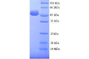 Hyaluronidase-1 (HYAL1) (AA 22-435) protein (His tag)
