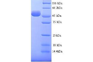 SDS-PAGE (SDS) image for Hyaluronidase-1 (HYAL1) (AA 22-435) protein (His tag) (ABIN4976067)