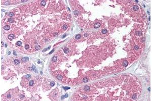 Human Kidney (formalin-fixed, paraffin-embedded) stained with AADAT antibody ABIN239800 at 2. (AADAT antibody  (N-Term))