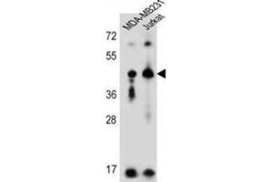 Western Blotting (WB) image for anti-Killer Cell Immunoglobulin-Like Receptor, Two Domains, Long Cytoplasmic Tail, 2 (KIR2DL2) antibody (ABIN3002433) (KIR2DL2 antibody)