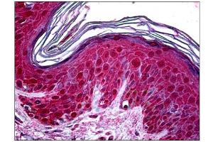 Immunohistochemistry (IHC) image for anti-Tumor Susceptibility Gene 101 (TSG101) antibody (ABIN781822)