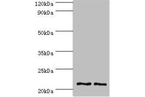 Western blot All lanes: DNAL1 antibody at 4 μg/mL Lane 1: Hela whole cell lysate Lane 2: HepG2 whole cell lysate Secondary Goat polyclonal to rabbit IgG at 1/10000 dilution Predicted band size: 22, 9, 18 kDa Observed band size: 22 kDa (DNAL1 antibody  (AA 41-190))