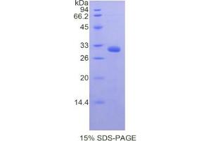 SDS-PAGE analysis of Mouse Myosin IA Protein. (Myosin IA Protein (MYO1A))