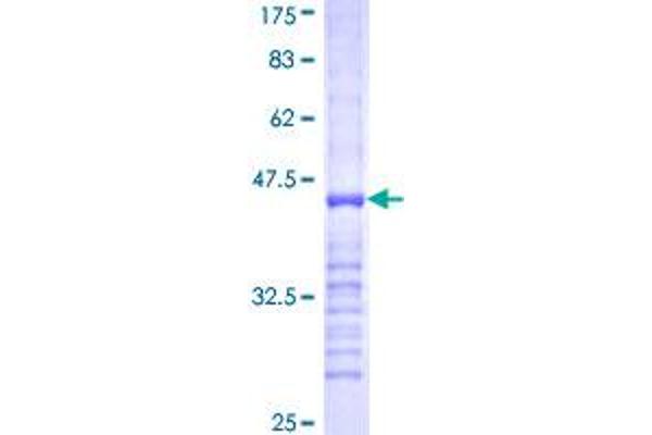 PDE1B Protein (AA 437-536) (GST tag)