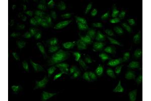 Immunofluorescence analysis of HeLa cell using YWHAB antibody. (YWHAB antibody  (AA 1-246))