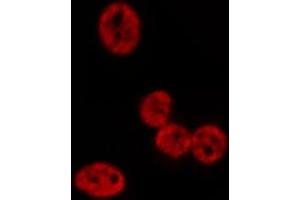 ABIN6276970 staining HepG2? (POLI antibody  (N-Term))
