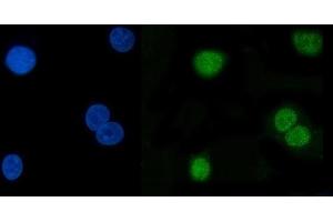 IF analysis of Hsp40/DNAJB1 using anti-Hsp40/DNAJB1 antibody (ABIN7602895).