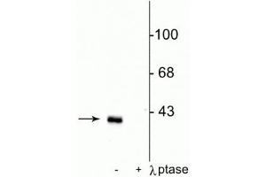 Western blot of rat striatal lysate showing specific immunolabeling of the ~32 kDa DARPP-32 phosphorylated at Thr75 in the first lane (-). (DARPP32 antibody  (pThr75))