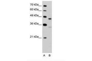 Image no. 2 for anti-G Protein-Coupled Receptor 161 (GPR161) (C-Term) antibody (ABIN203448) (GPR161 antibody  (C-Term))
