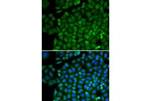 Immunofluorescence analysis of HeLa cells using SELENBP1 antibody (ABIN3021766, ABIN3021767, ABIN3021768 and ABIN1513508). (SELENBP1 antibody  (AA 243-472))