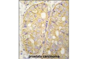 anti-POTE Ankyrin Domain Family, Member D (POTED) (AA 542-571), (C-Term) antibody