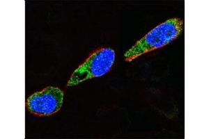 Confocal immunofluorescent analysis of Src antibody with A375 cells followed by Alexa Fluor 488-conjugated goat anti-rabbit lgG (green).