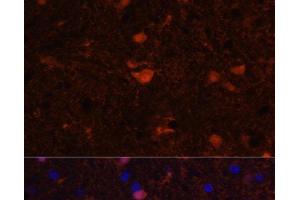 Immunofluorescence analysis of Rat brain using S100B Polyclonal Antibody at dilution of 1:100. (S100B antibody)