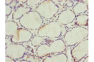 Immunohistochemistry of paraffin-embedded human thyroid tissue using ABIN7142596 at dilution of 1:100