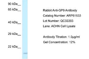 Western Blotting (WB) image for anti-Glycoprotein IX (Platelet) (GP9) (Middle Region) antibody (ABIN2774317) (CD42a antibody  (Middle Region))