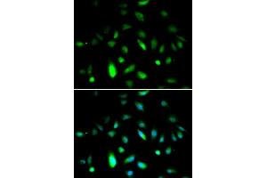 Immunofluorescence analysis of A549 cells using CCNB1 antibody (ABIN5971087). (Cyclin B1 antibody)