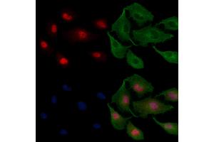 ABIN6258128 and ABIN6275417 staining  cells by IF/ICC. (DYRK3 antibody  (C-Term))
