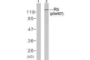Western blot analysis of extracts from K562 cells untreated or treated with 10% serum after 48 hours of starvation, using Rb (phospho-Ser807) antibody (E011131). (Retinoblastoma 1 antibody  (pSer807))