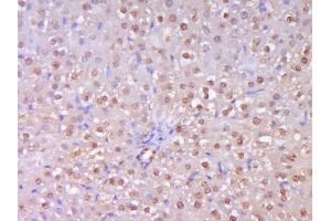 Paraformaldehyde-fixed, paraffin embedded Rat Liver Antigen retrieval by boiling in sodium citrate buffer (pH6. (TERT antibody  (AA 601-750))