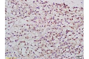 Formalin-fixed and paraffin embedded rat brain tissue labeled with Anti-PATZ1 Polyclonal Antibody, Unconjugated (ABIN759836) at 1:200 followed by conjugation to the secondary antibody and DAB staining