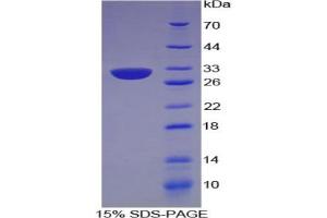 SDS-PAGE analysis of Human Centromere Protein I Protein. (CENPI Protein)