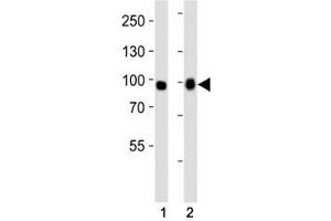 Western Blotting (WB) image for anti-Fibroblast Growth Factor Receptor 3 (FGFR3) (AA 449-482) antibody (ABIN3030955)