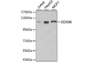 Western blot analysis of extracts of various cell lines, using DDX58 antibody. (DDX58 antibody  (C-Term))