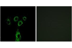 Immunofluorescence analysis of A549 cells, using GASP1 Antibody. (GPRASP1 antibody  (AA 741-790))