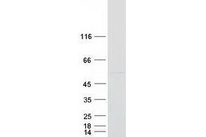 Validation with Western Blot